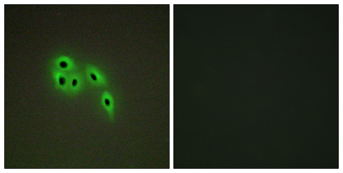 Dok-6 Rabbit Polyclonal Antibody