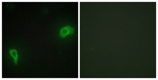 Dok-7 Rabbit Polyclonal Antibody