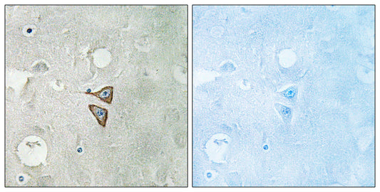 DOR-1 Rabbit Polyclonal Antibody