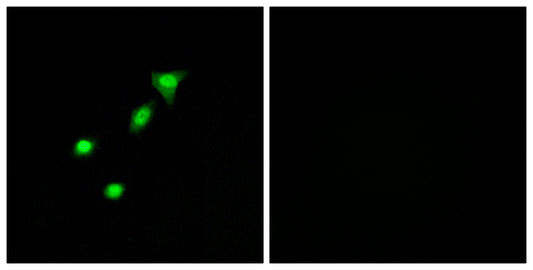 DPF2 Rabbit Polyclonal Antibody