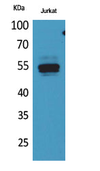 DPP7 Rabbit Polyclonal Antibody