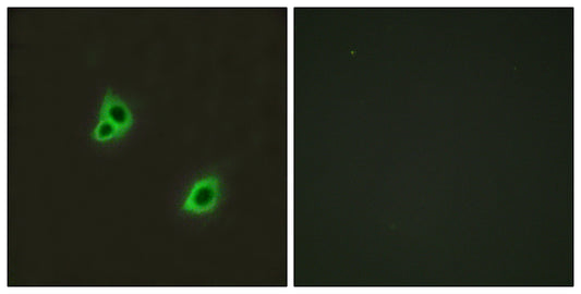 DREG Rabbit Polyclonal Antibody