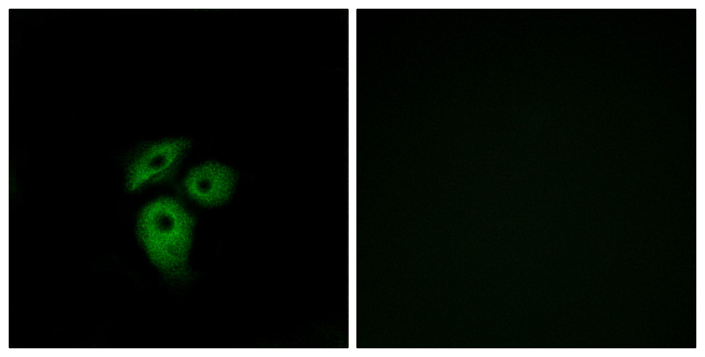 Duffy Rabbit Polyclonal Antibody