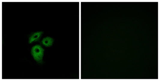 Duffy Rabbit Polyclonal Antibody