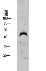 DUSP4 Rabbit Polyclonal Antibody
