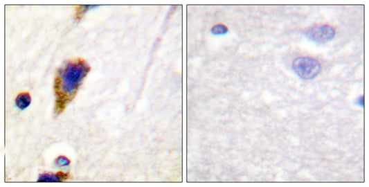 Dynamin I Rabbit Polyclonal Antibody