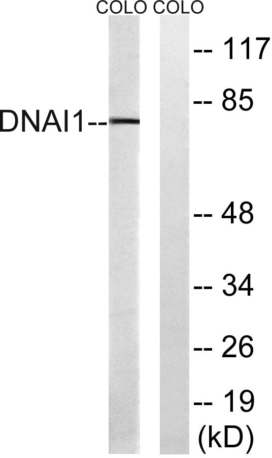 Dynein IC1 Rabbit Polyclonal Antibody