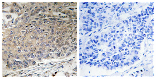Dynein LC 2 Rabbit Polyclonal Antibody