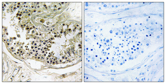 Dynein LC 2B Rabbit Polyclonal Antibody