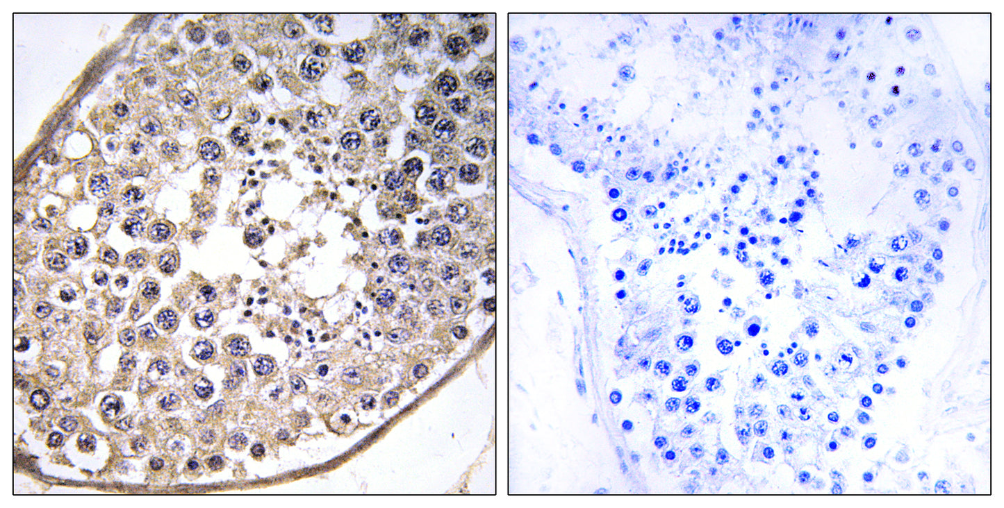 Dynein LC 4 Rabbit Polyclonal Antibody
