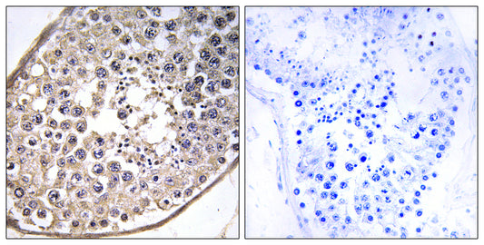 Dynein LC 4 Rabbit Polyclonal Antibody