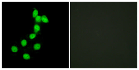 Dyrk1A Rabbit Polyclonal Antibody