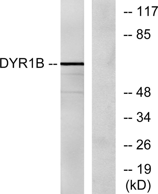 Dyrk1B Rabbit Polyclonal Antibody
