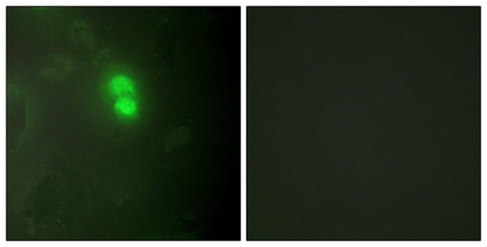 Dyskerin Rabbit Polyclonal Antibody
