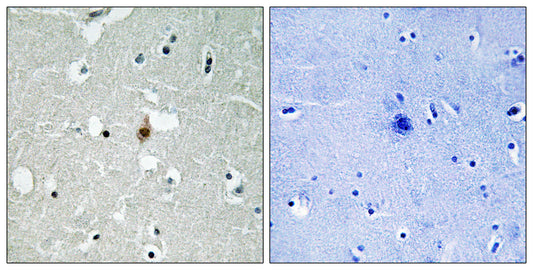 E2A Rabbit Polyclonal Antibody
