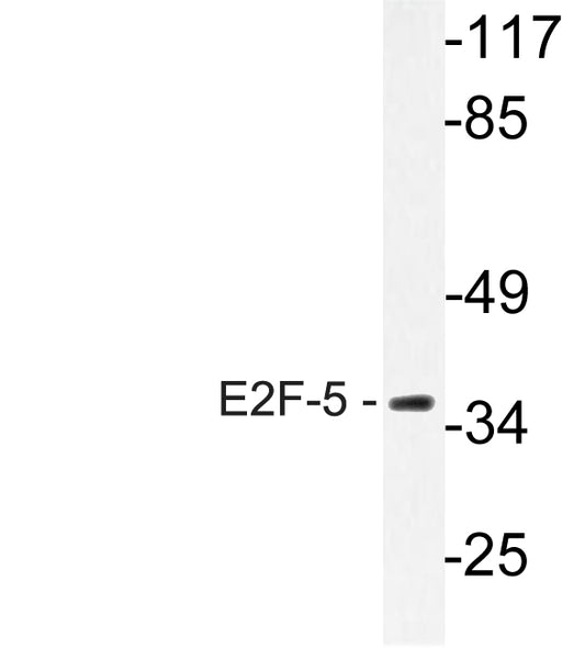 E2F-5 Rabbit Polyclonal Antibody
