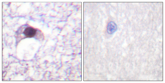 E2F-6 Rabbit Polyclonal Antibody