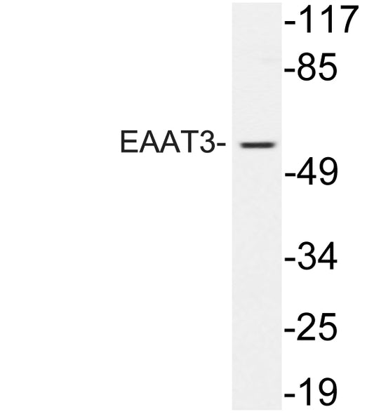 EAAT3 Rabbit Polyclonal Antibody