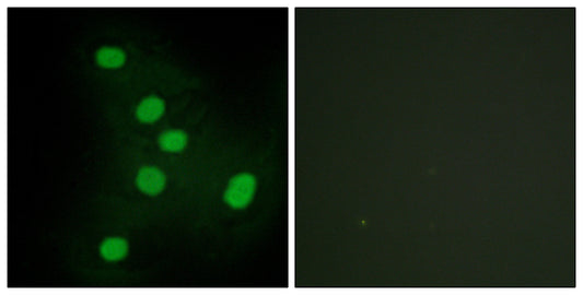 EAR2 Rabbit Polyclonal Antibody