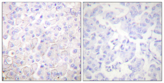 E-cadherin Rabbit Polyclonal Antibody
