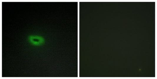 ECRG4 Rabbit Polyclonal Antibody