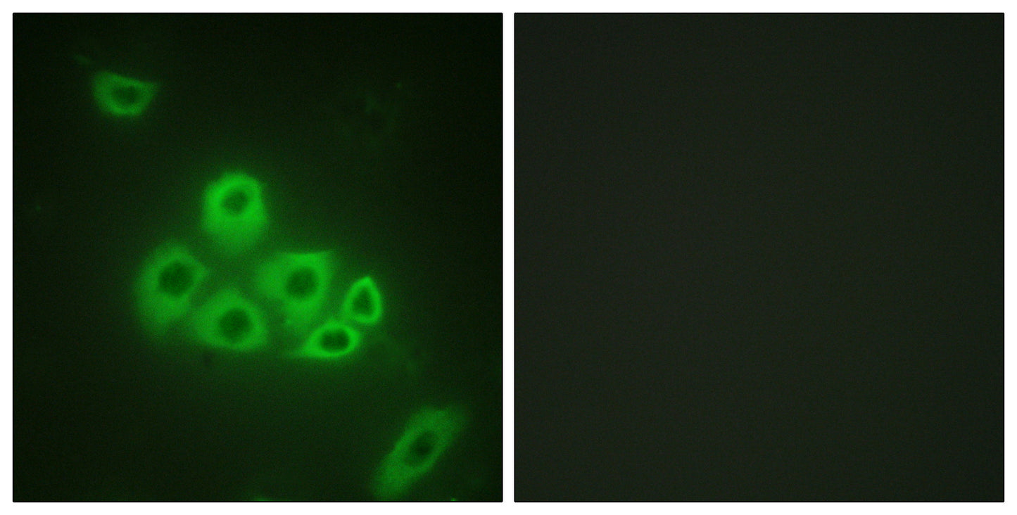 EDG-1 Rabbit Polyclonal Antibody