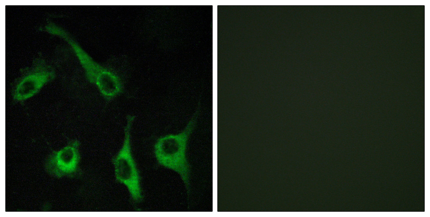 EDG-1 Rabbit Polyclonal Antibody