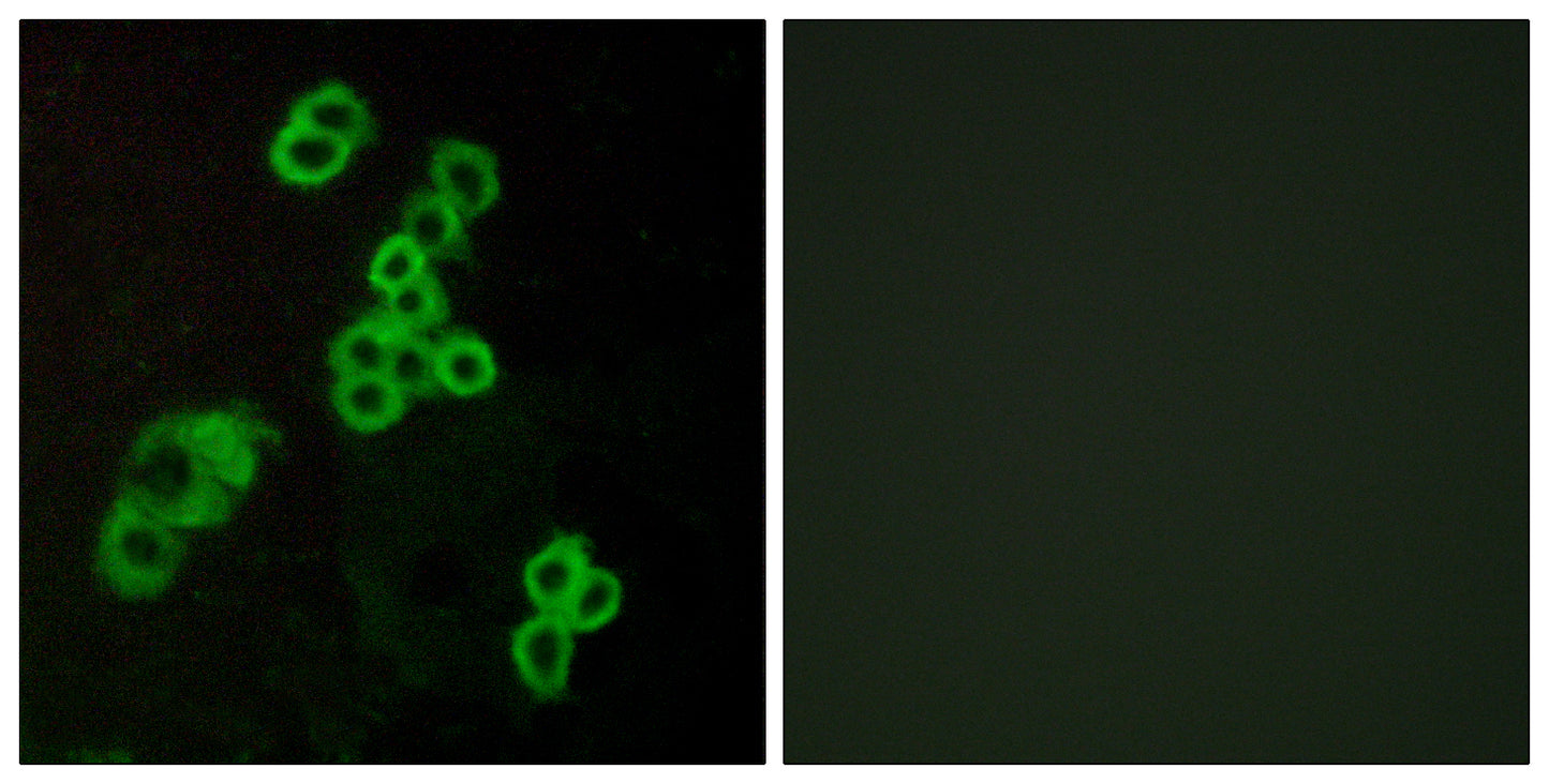 EDG-2 Rabbit Polyclonal Antibody