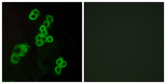 EDG-2 Rabbit Polyclonal Antibody