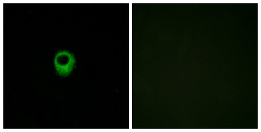 EDG-4 Rabbit Polyclonal Antibody