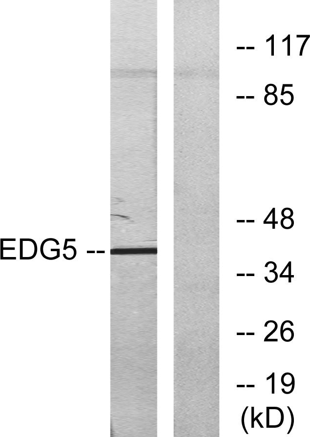 EDG-5 Rabbit Polyclonal Antibody