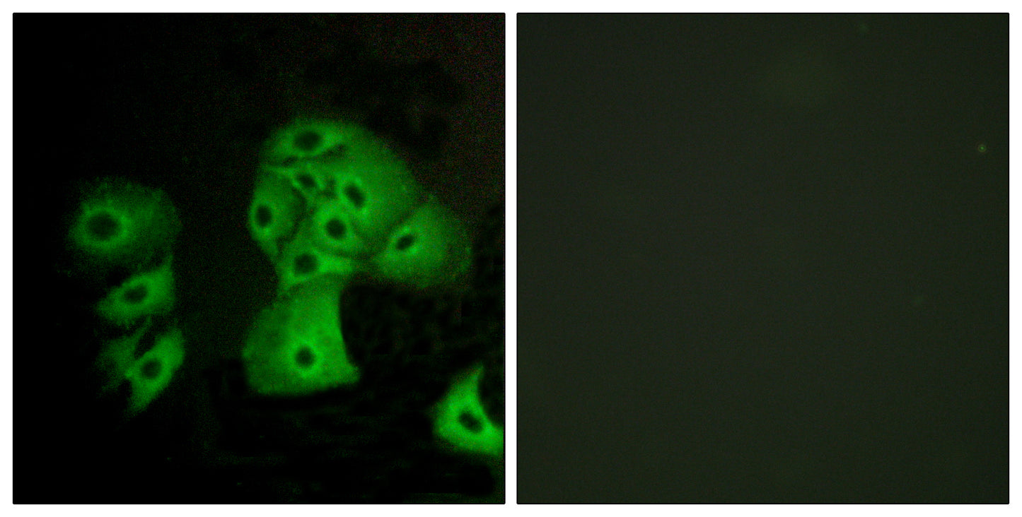 EDG-6 Rabbit Polyclonal Antibody