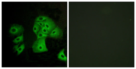 EDG-6 Rabbit Polyclonal Antibody