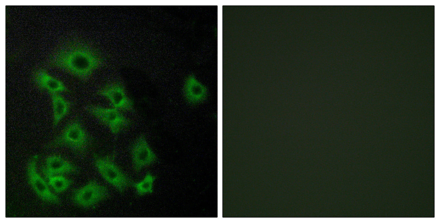 EDG-8 Rabbit Polyclonal Antibody