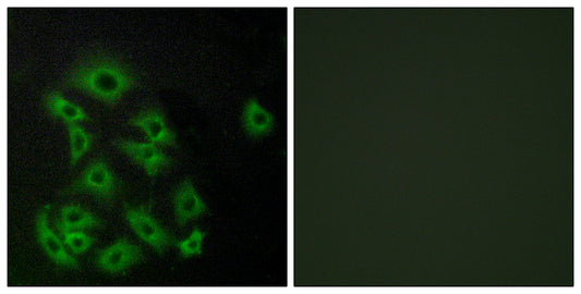 EDG-8 Rabbit Polyclonal Antibody