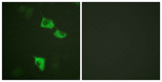 EF-2 Rabbit Polyclonal Antibody