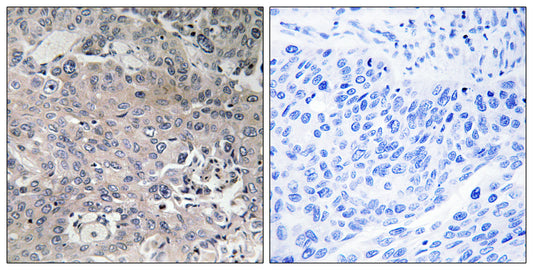 EF-Tu Rabbit Polyclonal Antibody