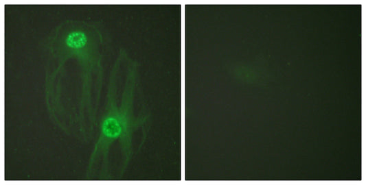 Eg5 Rabbit Polyclonal Antibody