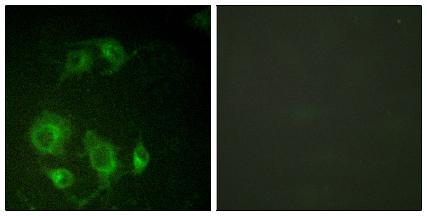 EGFR Rabbit Polyclonal Antibody
