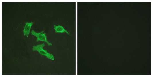 EGFR Rabbit Polyclonal Antibody