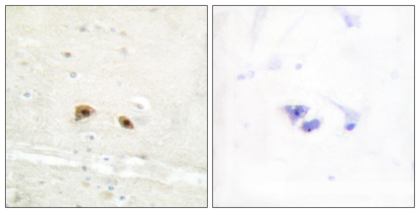 Egr-3 Rabbit Polyclonal Antibody