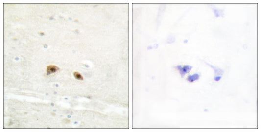 Egr-3 Rabbit Polyclonal Antibody