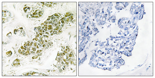 eIF2α Rabbit Polyclonal Antibody