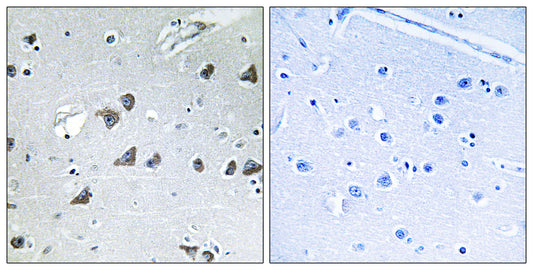 eIF3ε Rabbit Polyclonal Antibody