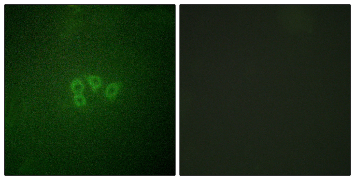 eIF4B Rabbit Polyclonal Antibody
