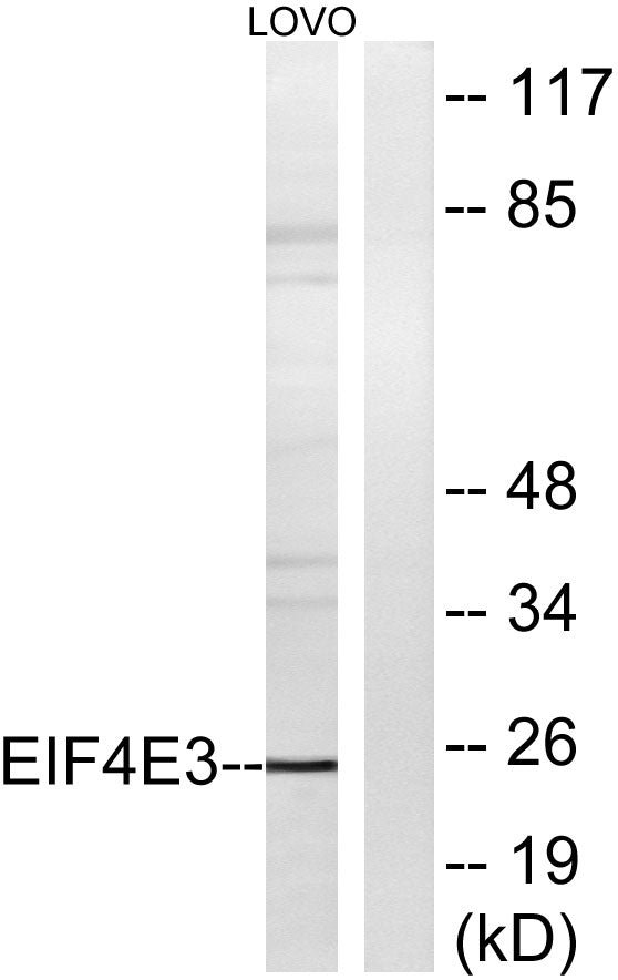 eIF4E3 Rabbit Polyclonal Antibody
