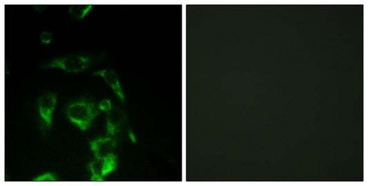 eIF4G Rabbit Polyclonal Antibody
