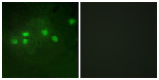 Elf-1 Rabbit Polyclonal Antibody