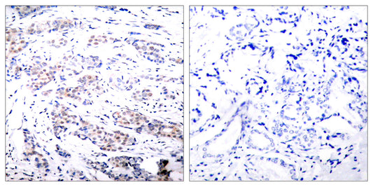 Elk-1 Rabbit Polyclonal Antibody