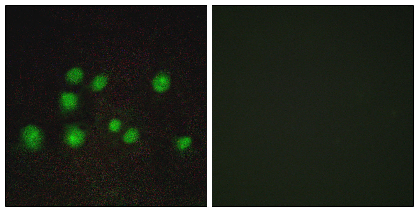 Elongin A2/3 Rabbit Polyclonal Antibody